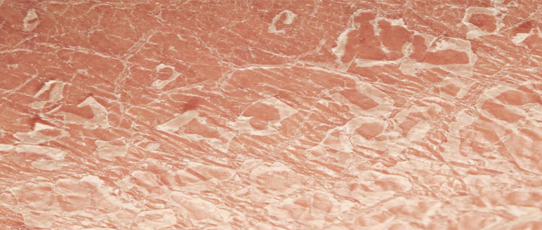 Earlier Treat Ichthyosis Skin Meet The Optimal Treatment Age